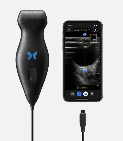Portable handheld ultrasound (Butterfly iQ+)